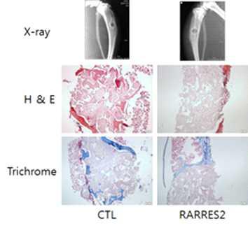 경골 천공모델을 이용하여 RARRES2가 첨 가된 HA-실크지지체의 골형성능 분석.