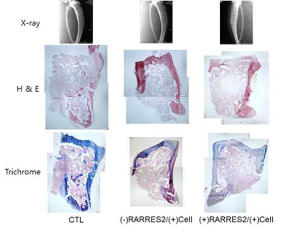 경골 천공 모델을 이용하여 중간엽줄기세포와 RARRES2를 탑재한 HA- 실크지지체의 골형성능 분석.