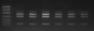 total RNA 추출 사진.