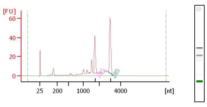 Agilent 2100 Bioanalyzer를 이용해 QC를 분석한 결과 예시.