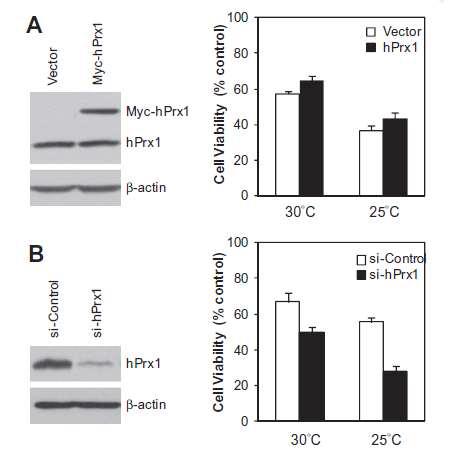 Prx1의 저온에 대한 저항성 측정