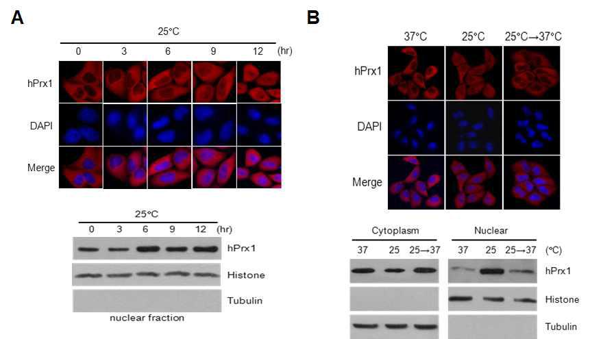 저온조건에서 Prx1의 세포내 위치 변화 분석