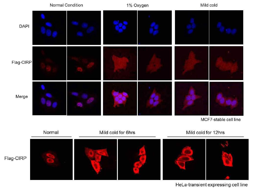 CIRP의 세포내 위치 및 스트레스에 대한 세포내 위치 변화 확인