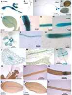 1.5kb promoter region upstream of DORN1 fused with GUS gene was transformed into Col-0 wild type plants