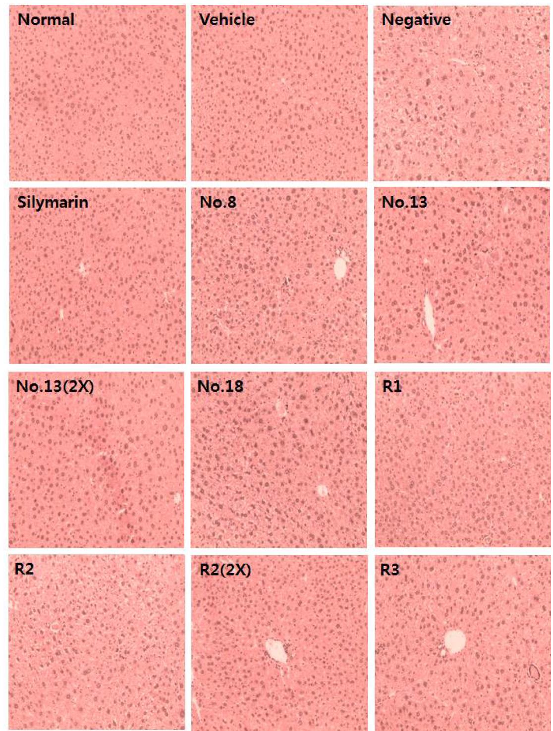 Results of H&E staining of liver tissue for analysis of the effect of Doenjang in CCl4-induced hepatotoxic mice