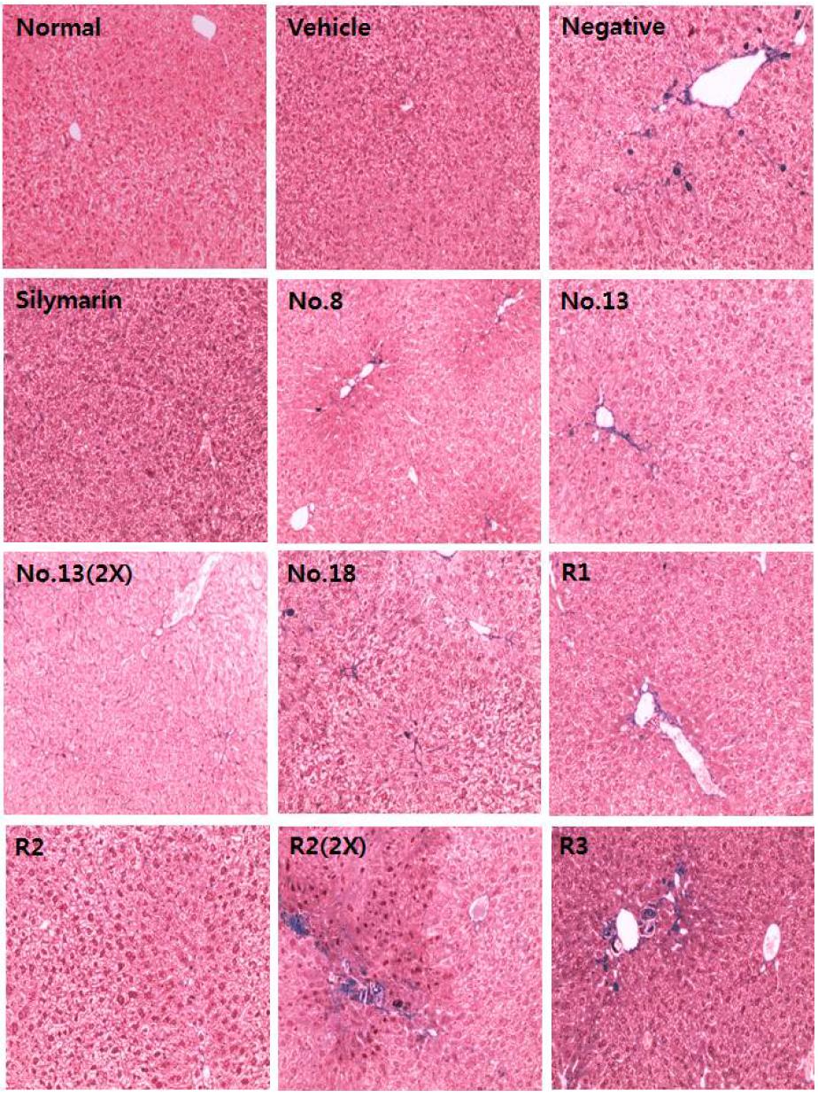 Results of MT staining of liver tissue for analysis of the effect of Doenjang in CCl4-induced hepatotoxic mice