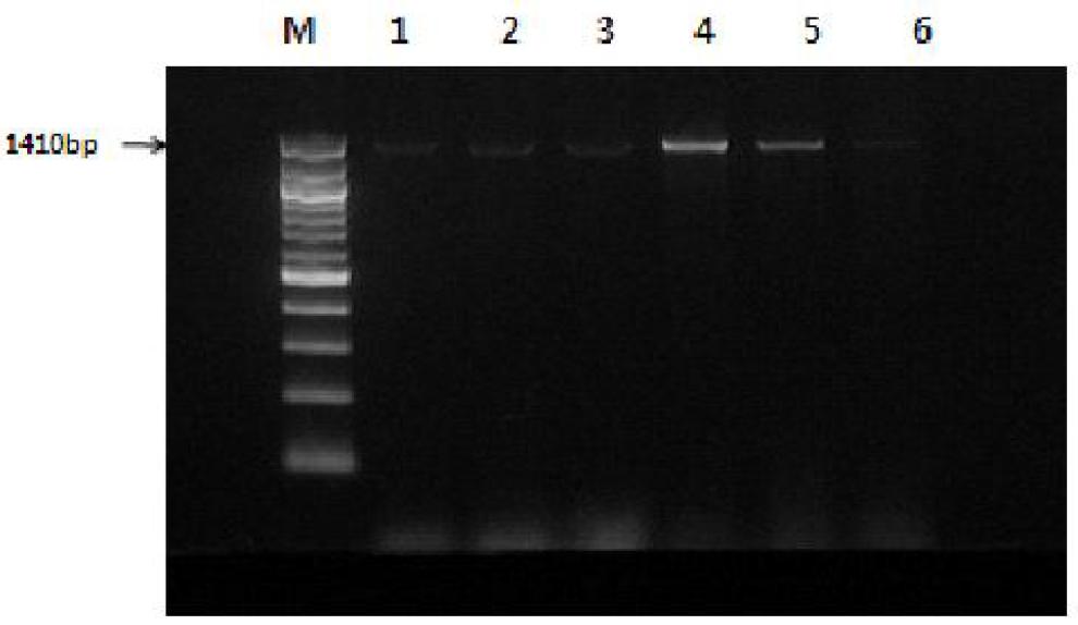 Electrophoresis of the amplified bglH gene from selected B.subtilis strains.