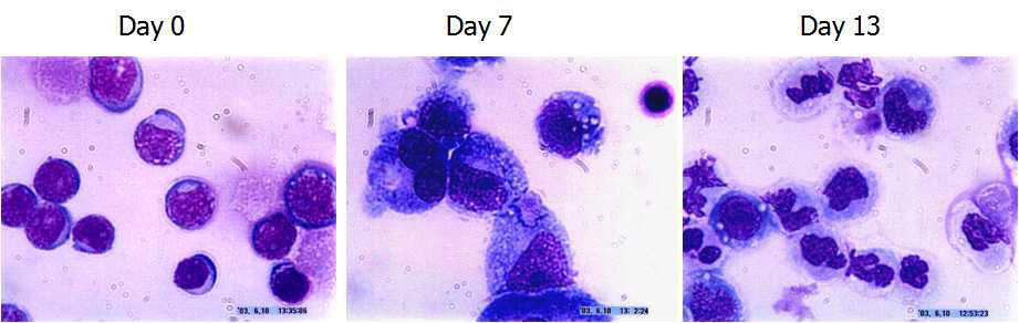 혈액줄기세포를 세포배양 상태에서 7일을 거쳐, 13일만에 Platelet, MK 세포로 분화