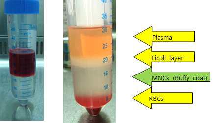골수 분리 후 Ficoll 방법에 의한 백혈구 및 중간엽세포 분리