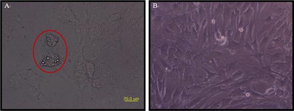 흑돼지 골수로부터 분리한 중간엽줄기세포의 세포주 확립과 분화능 검정