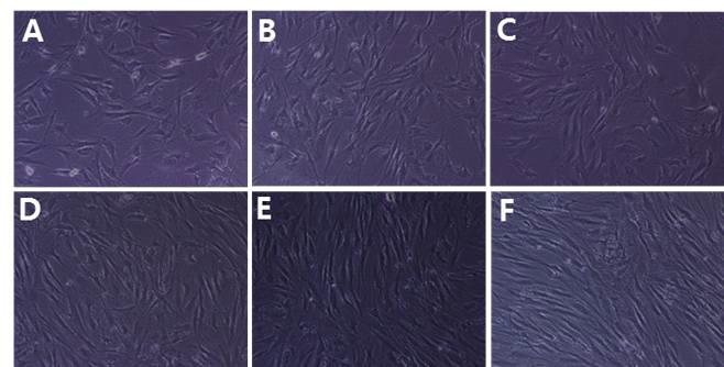 흑돼지 자돈 골수로부터 분리한 중간엽줄기세포로서 CD34, CD45, CD106, CD133, orc-kit 음성세포 구성됨