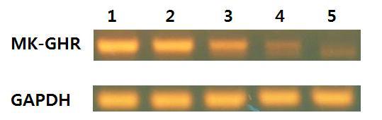 MK 세포 분화 세포 배양 후 GHR(growth hormone receptor) 유전자의 mRNA 발현양상