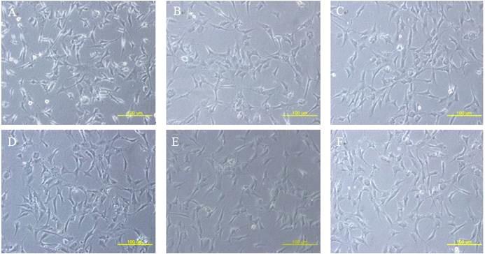 MK 분화를 위한 흑돼지 자돈 골수 유래 중간엽줄기세포와 CD34+ 세포의 공배양
