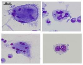 Megakaryocyte (MK)의 giemsa 염색 양상