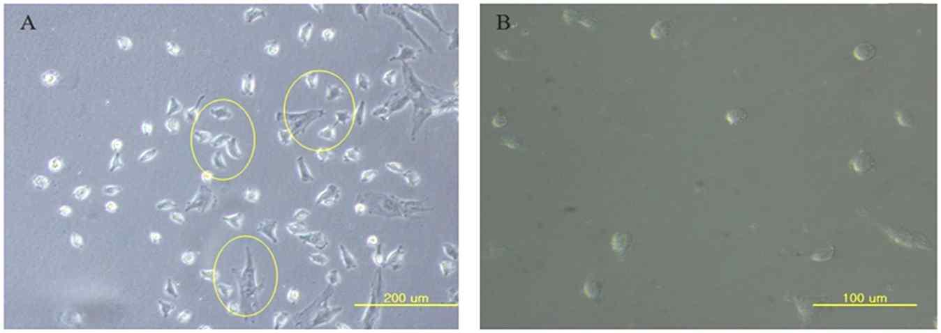 흑돼지 자돈 골수 유래 CD34+ 분리 및 배양