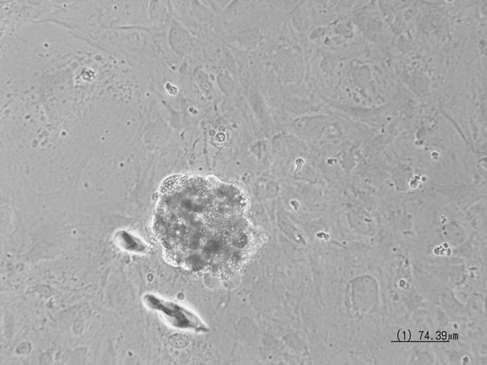 복제배반포 (Westran male pig WT2)가 MEF 세포에 attach 되었음 (Day 0 ofESC isolation).