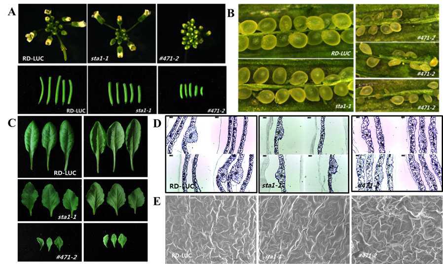 Overall phenotype of sta1-1 enhancer/suppressor, #471-2