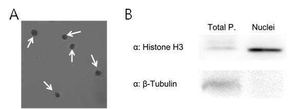 분리된 세포 핵 (A) 및 세포 핵 층의 quality control을 위한 Histone H3, α-/β-Tubulin 항체를 이용한 western 검증 (B)