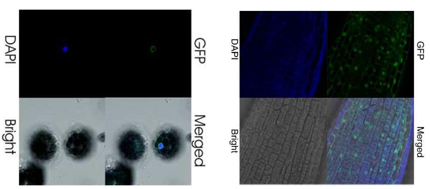 p35S-NTF#31의 잎과 잎을 이용하여 얻은 protoplast 현광현미경 분석조사