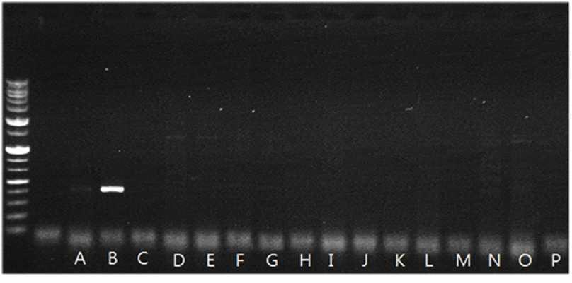 열풍처리 후 키다리병균을 PCR한 결과, (1kb(+) DNA ladder(Enzynomics))