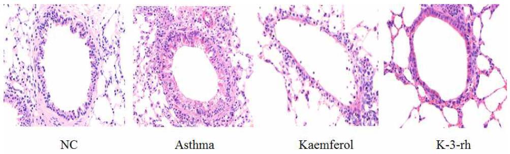 Effect of KF and K-3-rh on airway inflammation caused by cell infiltration in lung tissue.