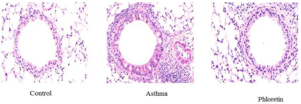 Effect of phloretin on airway inflammation caused by cell infiltration in lung tissue.