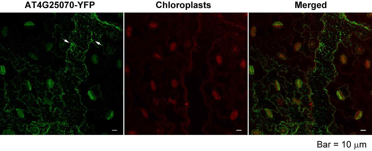 Unknown protein At4g25070의 subcellular localization. 화살표는 세포질에 나타나는 blob들을 나타낸다.