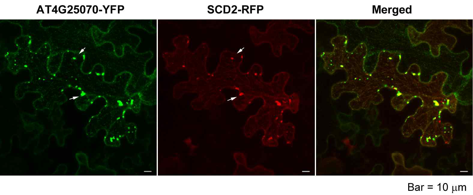 At4g25070-YFP와 SCD2-RFP의 co-localization. 화살표는 cytoplasmic vesicle에서 두 단백질이 일치하고 있음을 나타낸다.