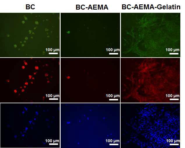 BC, AEMA-g-BC, 그리고 Geatin/AEMA-g-BC위에 증식된 NIH 3T3 세포의 형광염색을 통한 세포의 증식 및 흡착 이미지 (배율: 200×)