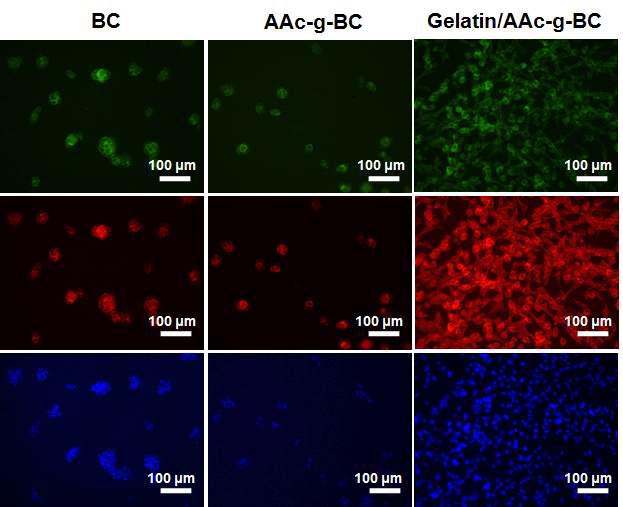 BC, AAc-g-BC, 그리고Geatin/AAc-g-BC위에 증식된 NIH 3T3 세포의 형광염색을 통한 세포의 증식 및 흡착 이미지 (배율: 200×)