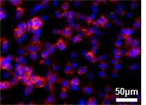 Gelatin/AAc-g-BC위에 증식된 NIH 3T3 세포의 형광염색을 통한 세포의 증식 및 흡착 이미지 (배율: 400×)
