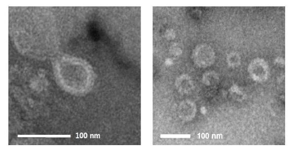 재조합 TN-5B14/M1-M2-HA-NA 세포 배양배지의 sucrose cushion 초원 심분리, 밀도구배 초원심분리를 통해 확보한 4, 5번 분획 혼합물에 VLP가 존재하는 것을 전자현미경 관찰로 확인함.