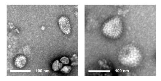 재조합 배큘로바이러스 rBac/NA, rBac/HA가 감염된 재조합 TN-5B1-4/M1-M2 세포 배양배지의 sucrose suchion 초원심분리, 밀도구배 초원심분리를 통해 확보한 4, 5번 분획 혼합물에 VLP가 존재하는 것을 전자현미경 관찰로 확인함.