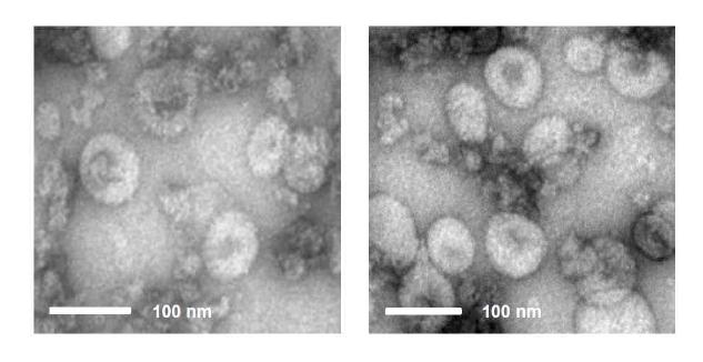 재조합 배큘로바이러스 rBac/M1, rBac/M2, rBac/NA, rBac/HA가 감염된 TN-5B1-4 세포 배양배지의 sucrose cushion 초원심분리, 밀도구배 초원심분리를 통해 확보한 3, 4, 5, 6번 분획 혼합물에 VLP가 존재하는 것을 전자현미경 관찰로 확인함