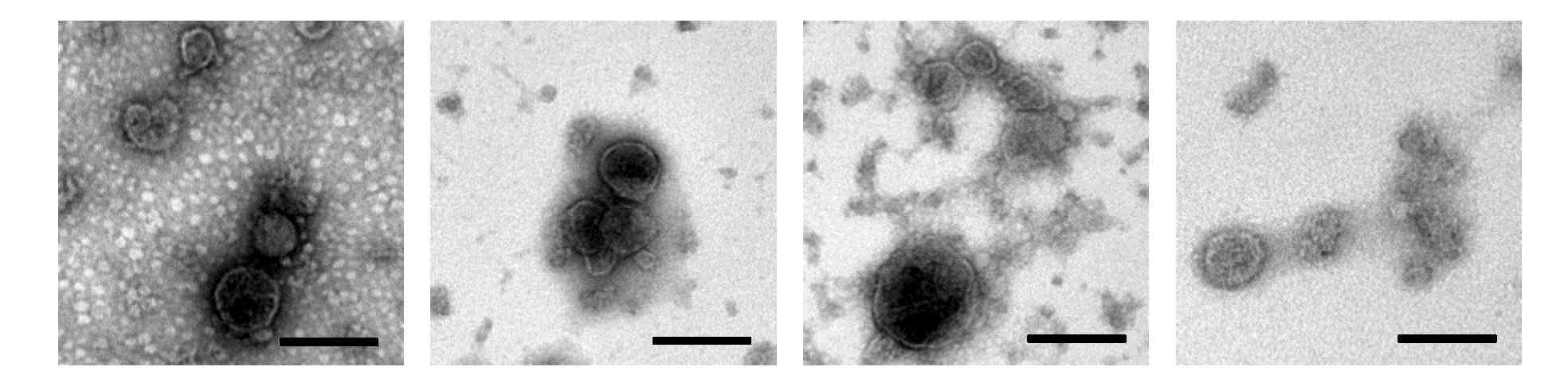 재조합 TN-5B14/M1-6xM2e-HA-TMD 세포 배양배지의 sucrose cushion 초원심분리, 밀도구배 초원심분리를 통해 확보한 2, 3, 4번 분획 혼합물에 VLP가 존재하는 것을 전자현미경 관찰로 확인함