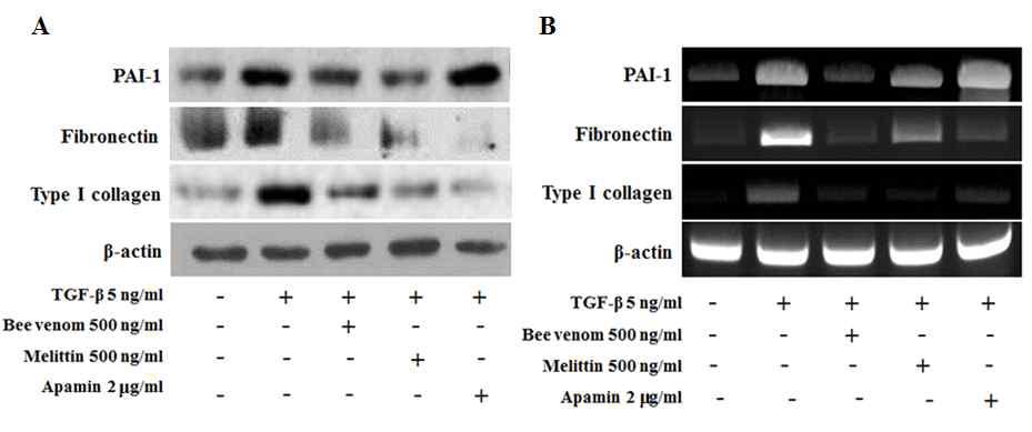 봉독의 TGF-β로 유도된 섬유화 마커인자 조절 효능 확인