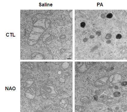 NAO 처리에 의한 미토콘드리아의 자가포식 억제능 확인