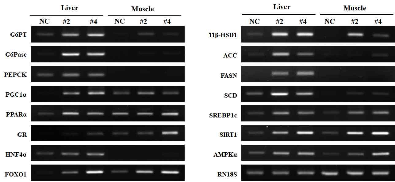 간과 근육에서 11β-HSD1의 과발현에 따른 당·지질대사 관련 유전자의 발현 양상