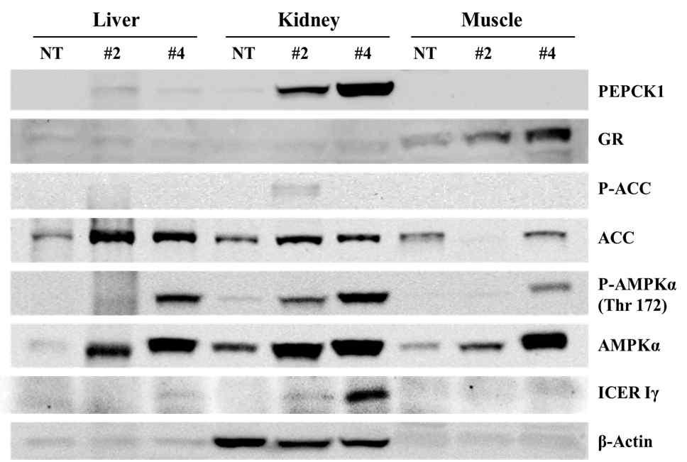 형질전환 돼지에서 11β-HSD1 과발현에 따른 반응단백질들의 발현 양상 및 활성화