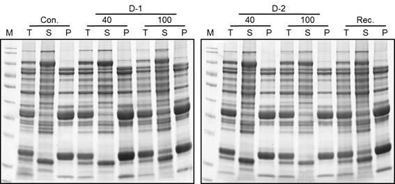 저장 조건에 따른 콩 종자 단백질 SDS-PAGE 분석
