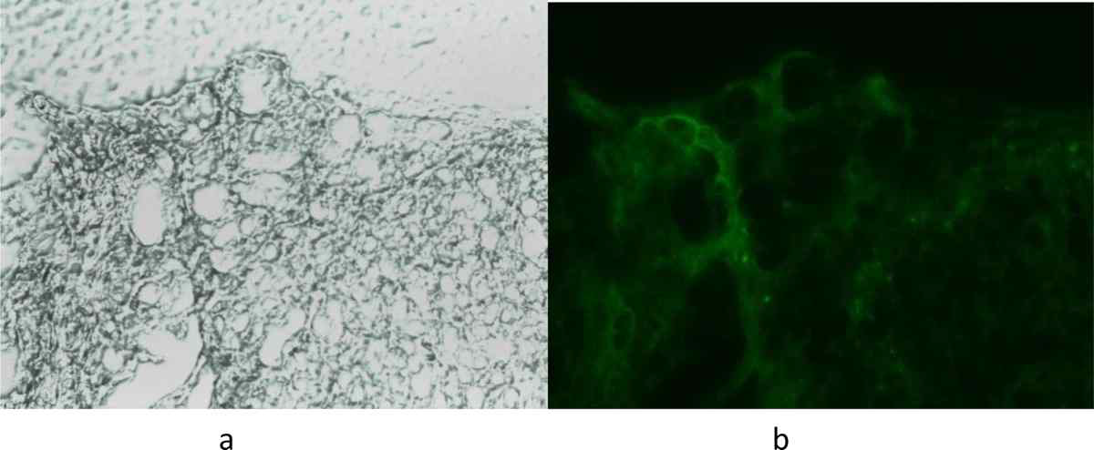 형광현미경은 경구로 들어가 소장의 식세포에서 GFP 유전자가 발현되고 있는 재조합 효모를 보여줌 (구강 예방 접종 후 60시간).