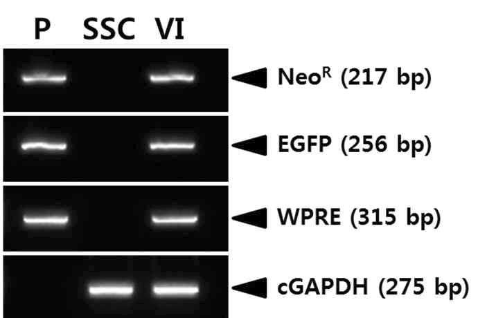 Detection of the transgene in SSC infected with LNRGW virus.