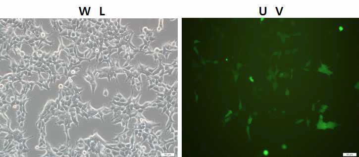 Expression of the EGFP gene in pPB-EGFP-Puro transfected 293 cells.