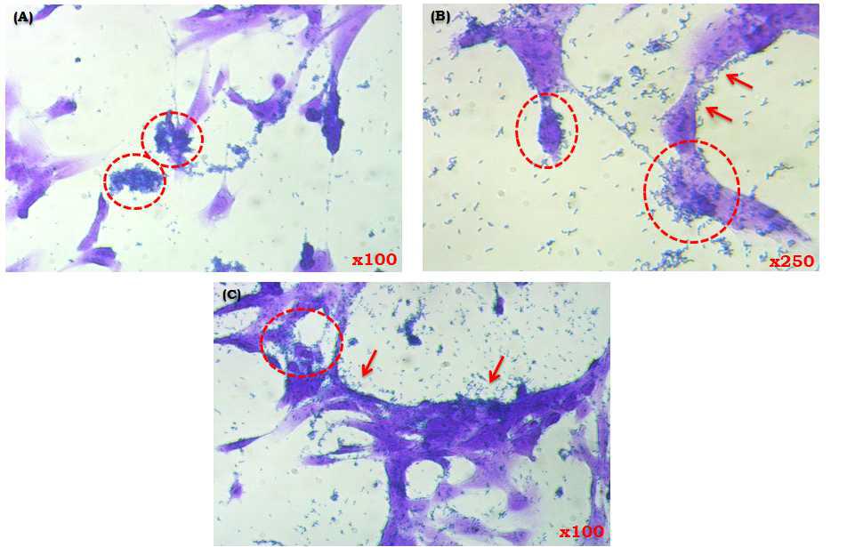 Adhesion of different strains to the human intestinal cell lines (CCD-18Co) as observed by differential and Gram straining under a light microscope.