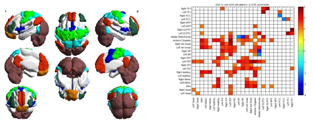 Resting-state fMRI 지역간의 연결성 분석 결과