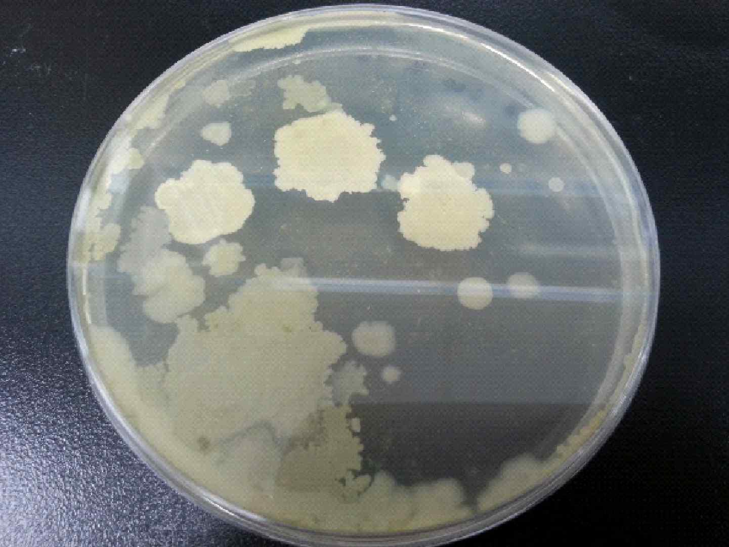 Bacillus cereus colony