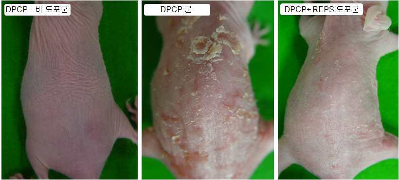 DPCP에 의해 유도된 아토피 피부염에 대한 새싹땅콩 추출물(REPS)의 영향