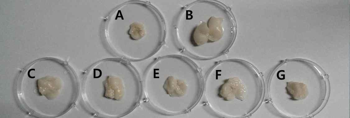 Pictures of epididymal adipose tissue of mice fed high fat diet with lactic acid bacteria for 6 weeks.