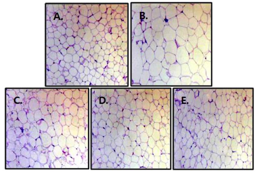Histological images of epididymal fat tissue from rats fed normal or high fat diet for 8 weeks