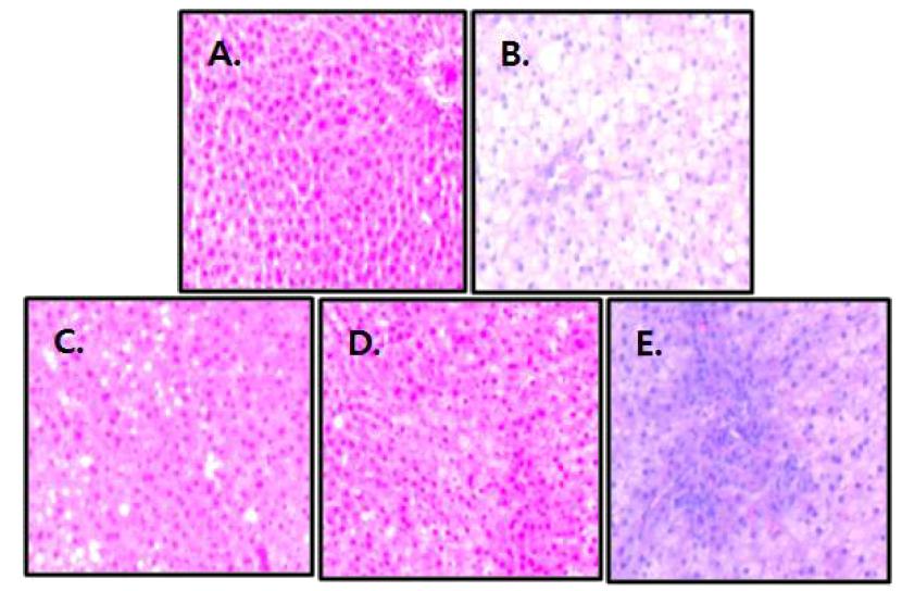 Histological profiles of liver tissue from rats fed normal or high fat diet for 8 weeks